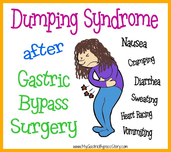 dumping-syndrome
