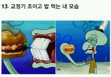 치아교정의 고통 ㄷㄷㄷ.jpg | 인스티즈